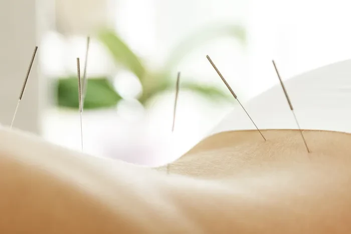Alternative Medizin blickt auf eine lange Tradition zurück