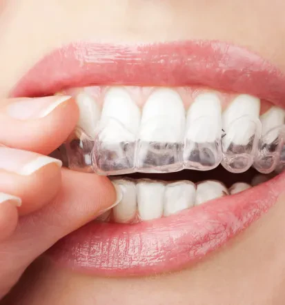 Orthodontist for invisible braces