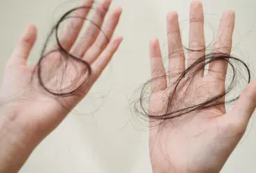 Haarausfall? Ein Dermatologe kann helfen!