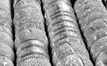 Metallprodukte im Wandel: Innovation trifft Handwerk