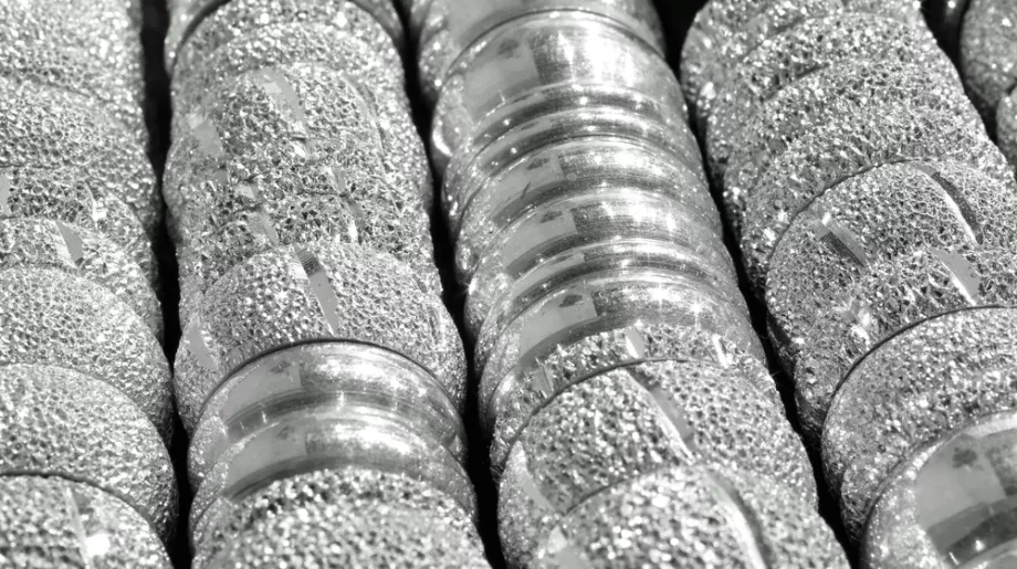 Metallprodukte im Wandel: Innovation trifft Handwerk